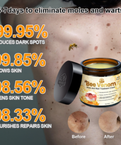 Brezey™ Bee Venom Mole and Wart Treatment Cream