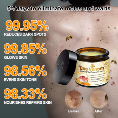 Brezey™ Bee Venom Mole and Wart Treatment Cream