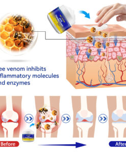 Ourlyard™ Bee Venom Joint Therapy Cream: Relieve stiffness and swelling