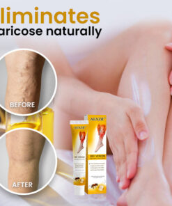 AEXZR™ Bee Venom Varicose Cure Cream