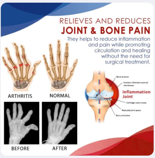 AEXZR™ Joint & Bone Therapy Foam