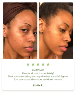 Anti-Acne & Dark Spots African Soap Bar