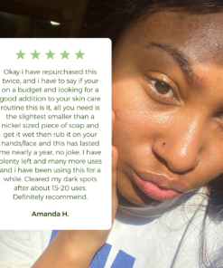 Anti-Acne & Dark Spots African Soap Bar