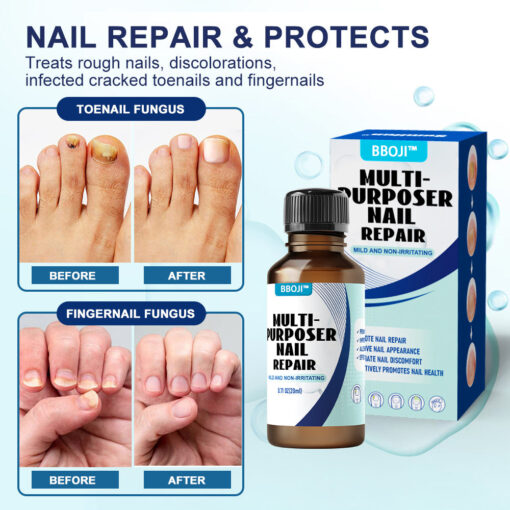 BBOJI™-Fungal Nail Repair Solution