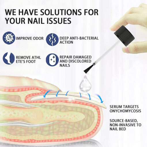 BBOJI™-Fungal Nail Repair Solution