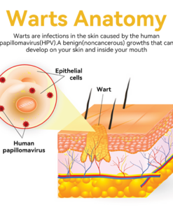 Bee Venom Wart & Moles Removal Cream