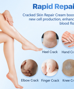 Biancat™ Cracked Skin Repair Cream