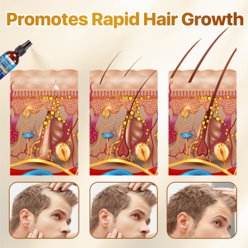 Biancat™ HairRevive Hair Growth Spray