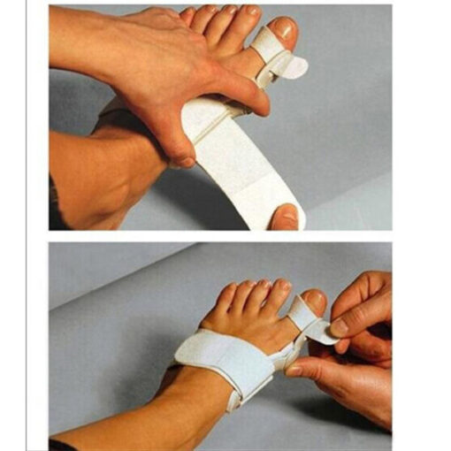 Bunion Corrector