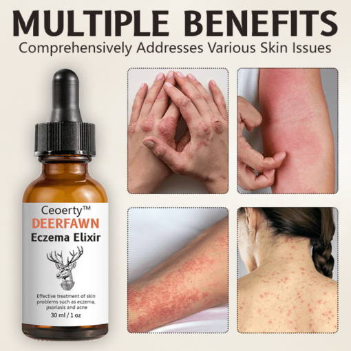 Ceoerty™ DeerFawn Eczema Elixir