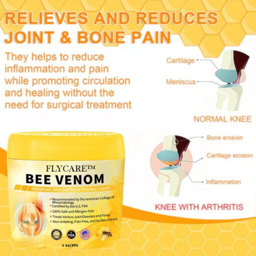 FLYCARE™ Bee Venom Advanced Joint and Bone Therapy Cream