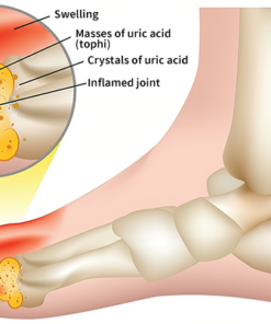 FLYCARE™ Bee Venom Advanced Joint and Bone Therapy Cream