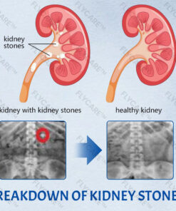 FLYCARE™ NephroFlex Kidney Boost Patch