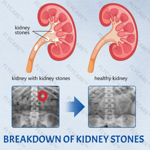 FLYCARE™ NephroFlex Kidney Boost Patch