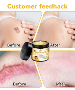 Furzero™ Bee Venom Skin Treatment Cream