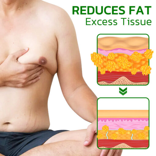 GFOUK™ Turmeric-Max Gynecomastia Compress Patch