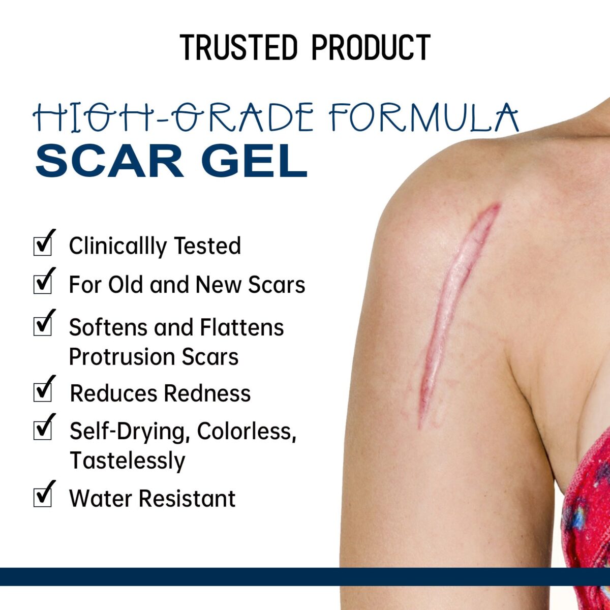 LOVILDS™ PREMIUM FORMULA Scar Gel