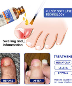 Lotmay® Bee Venom Nail Fungus Treatment Solution