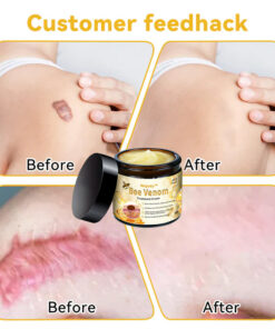 Negusy™ Bee Venom Skin Treatment Cream