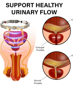 Oveallgo™ CuPro Magnetic Prostate Health Bracelet