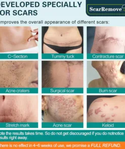 ScarRemove For All Types of Scars