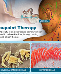 TinniLief™ Herbal Tinnitus Treatment Roller