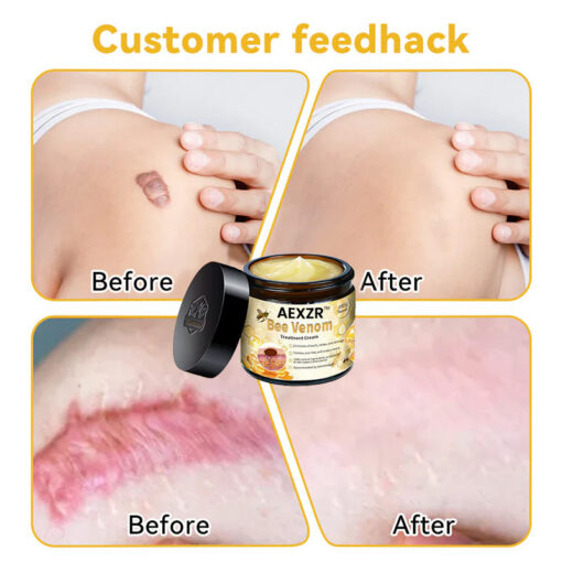 AEXZR™ Bee Venom Skin Treatment Cream