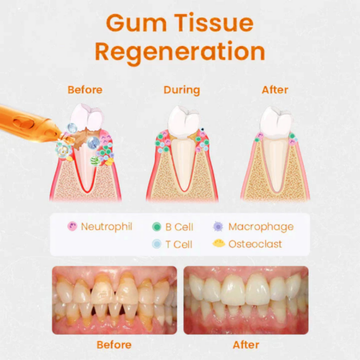 AEXZR™ Gum Repair Treatment Ampoules