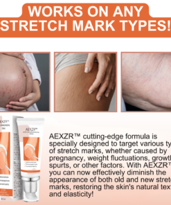 AEXZR™ Stretchmarks Removal Cream