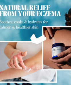 All Natural Eczema Soothing Cream