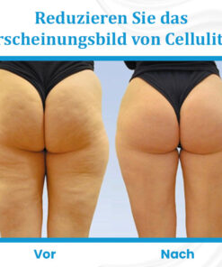 Ceoerty™ EternaLIFT Ultra Straffende Hautcreme