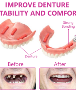 Ceoerty™ SureFit Thermal Denture Adhesive