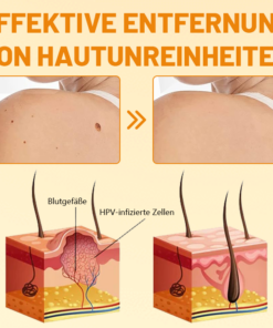 Ceoerty™ VenomErase Hauterneuerungscreme