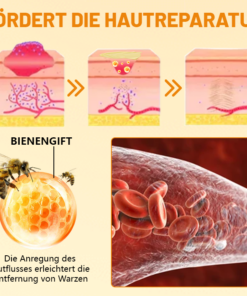 Ceoerty™ VenomErase Hauterneuerungscreme