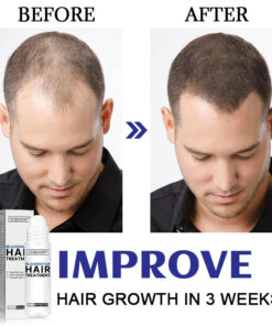 Dobshow™ Hair Rejuvenation Treatment