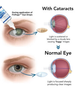 Fivfivgo™ Myopia Reversal Eye Drops