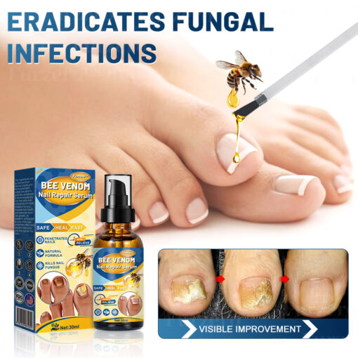 Furzero™ Bee Venom Nail Repair Serum