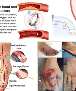 Lymphatic Magnetic Luminous Ring