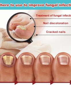 Nail Care Night Patches