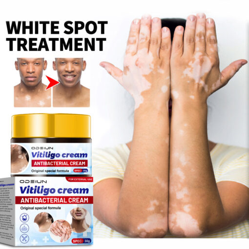 ODEIUN™ BeeVenom Vitiligo Treatment Cream