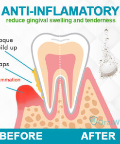 OralWiz™ Gum Care Tablets