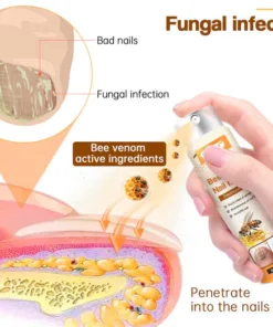 Ourlyard™ Bee Venom Nail Fungus Spray