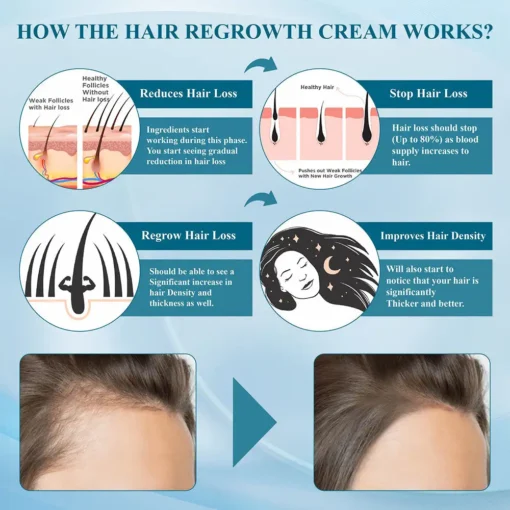 STOVIS™ Alopecia Recovery Hair Regrowth Cream