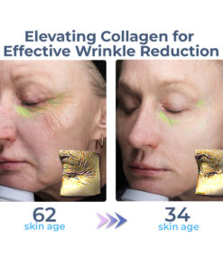 flysmus™ Advanced Collagen Complete Eye Cream