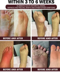 30-Herb Slimming & Detox Foot Bath Medicinal Drops