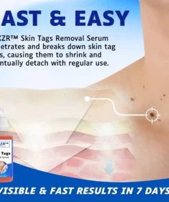 AEXZR™ Skin Tags Removal Serum