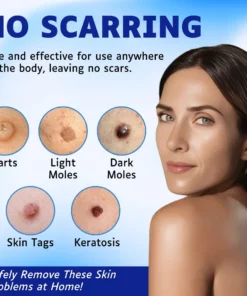 AEXZR™ Skin Tags Removal Serum