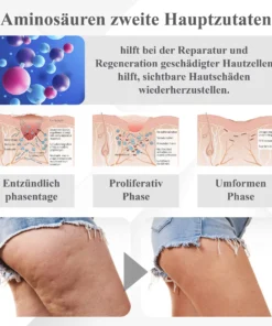 ATTDX™ Insulin Gewichtskontroll Körpercreme