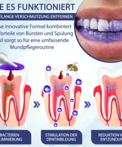 ATTDX™ Konzentrierte Mellifera-Gift Mundpflege Zahnpasta