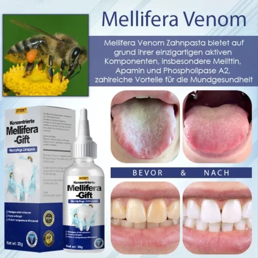 ATTDX™ Konzentrierte Mellifera-Gift Mundpflege Zahnpasta